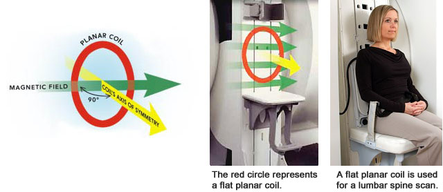 The UPRIGHT MRI Can Use Flat Planar Coils just like High-Field MRIs